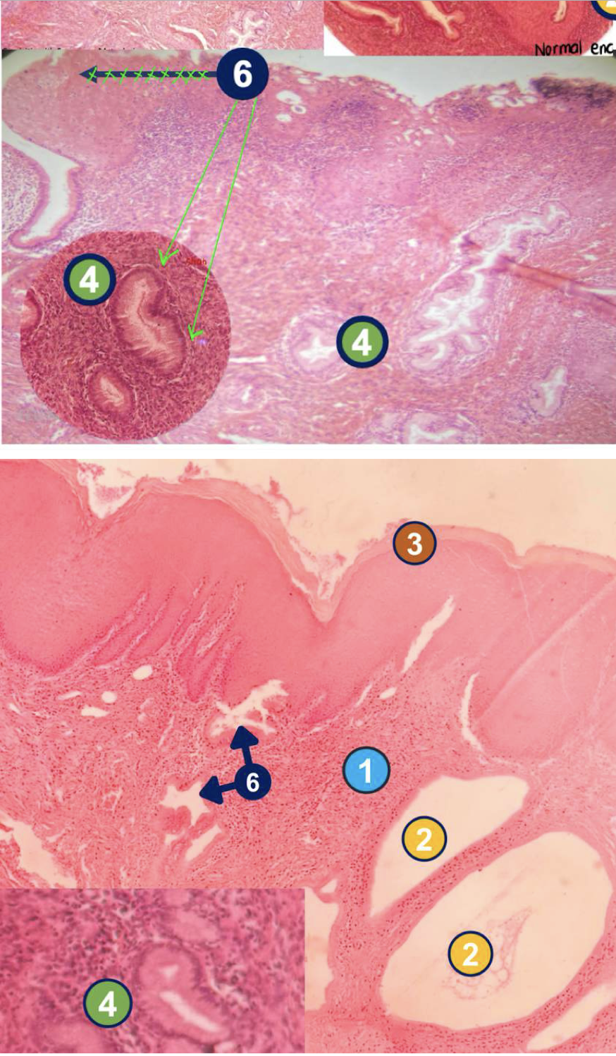 <p>Diagnose and identify metaplasmic change</p>
