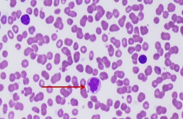 <p>Tế bào gì ?</p>