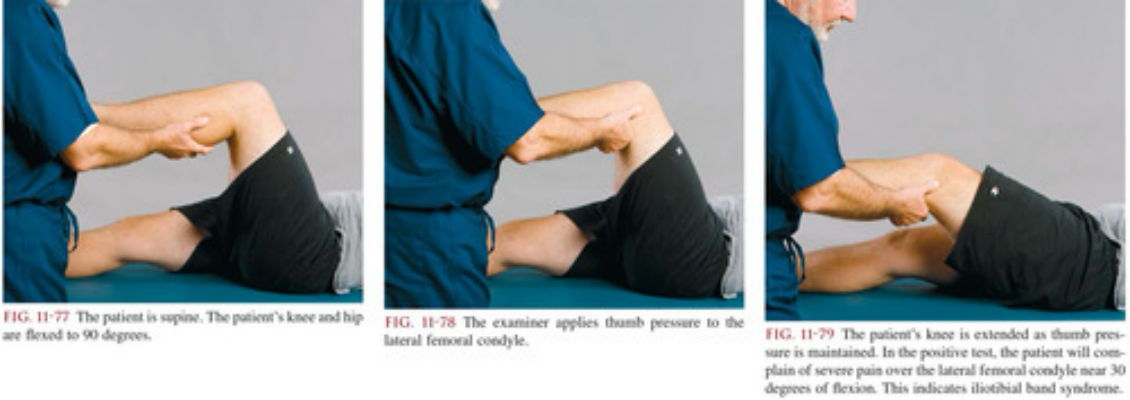 <p></p><ul><li><p><strong>Noble's Compression Test!</strong></p></li><li><p>Patient is supine on the table, bends their knee, and the PT palpates gerdy's tubercle</p></li><li><p>PT starts patient in knee flexed position and moves to extension while palpating for movement of the IT band</p></li><li><p><strong>Positive = Reproduction of Pain / Symptoms</strong> </p></li></ul><p></p>