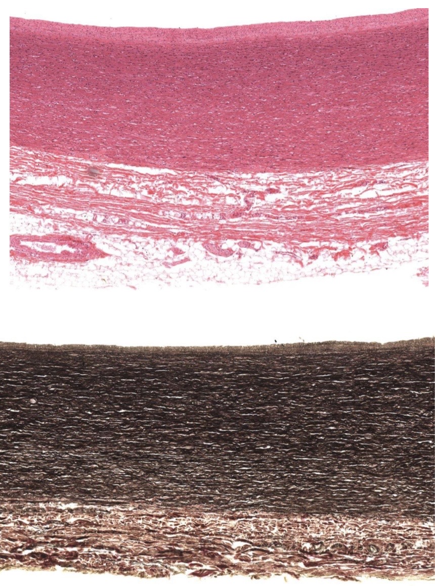 <p>Idenitfy the Vessel and what are the Properties?</p>