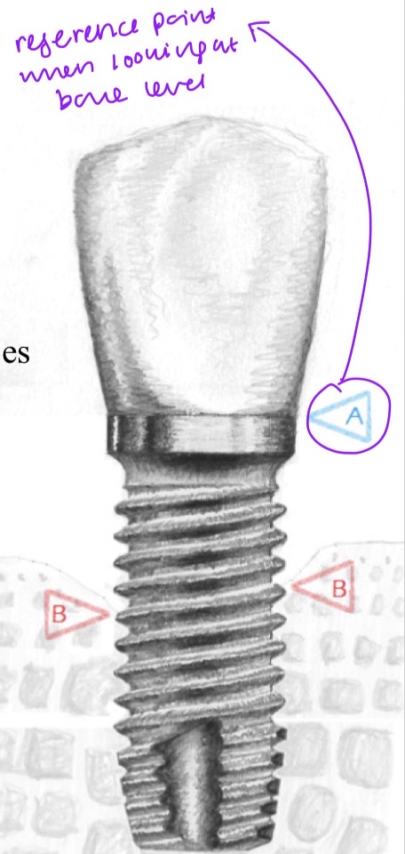 <p>Use fixed, non variable points to monitor progression</p><p>OPG, periapical</p><p>CBCT- BUT only shows interproximal bone levels (need clinical exam to confirm)</p>