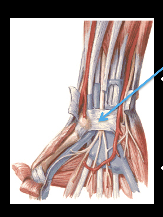 <p><u>Attaches to:</u></p><p>•pisiform bone and hook of hamate bone <mark data-color="purple" style="background-color: purple; color: inherit;">(medially)</mark></p><p><mark data-color="red" style="background-color: red; color: inherit;">•tubercles of scaphoid and trapezium bones</mark> <mark data-color="purple" style="background-color: purple; color: inherit;">(laterally)</mark></p><p><u>Forms a tunnel for 10 things: </u>(carpal tunnel)</p><p>•4 tendons of the flexor digitorum superficialis m.</p><p>•4 tendons of the flexor digitorum profundus m.</p><p>•tendon of the flexor pollicis longus m.</p><p>•median nerve</p>