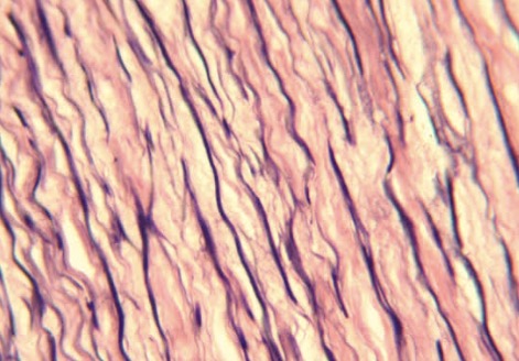 <p>Structure: densely packed elastic fibers </p><p>Function: stretching and recoil </p><p>Location: walls of arteries trachea vocal cords </p>