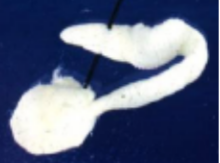 <p>Taenia taeniaformis (rat tapeworm) life cycle</p>