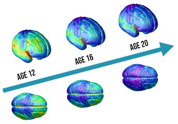 <p><strong>Research Method </strong>= longitudinal study, 13 ppts aged 5-20, anatomical brain scans approx every 2 years </p><p><strong>Key Findings:</strong></p><ul><li><p>different brain regions mature at different rates</p></li><li><p>regions involved in spatial perception mature relatively early </p></li><li><p>frontal regions associated with planning + critical thinking continue developing into the early 20s</p></li><li><p>temporal regions associated with learning + memory are among the later regions to mature </p></li></ul><p>= brain doesn’t develop everywhere at the same time </p><p>= helps explain why adolescent cognitive abilities develop gradually </p><p></p>