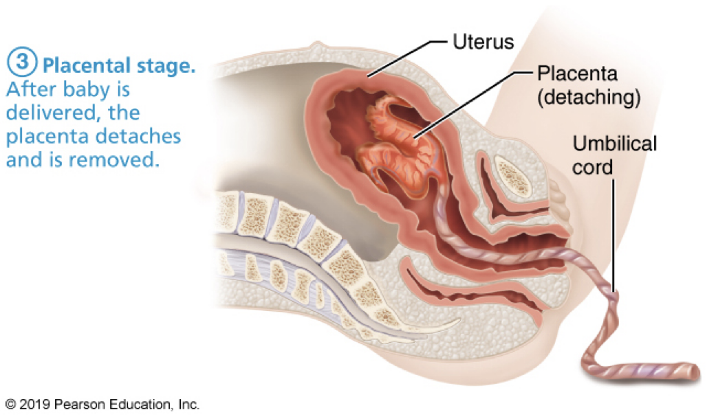 <p>labor: <strong>placental stage</strong></p><ul><li><p>uterus continues to ___</p><ul><li><p>contractions of myometrium ___</p></li></ul></li><li><p>placenta & amniotic sac (afterbirth) ___</p></li></ul><p></p>