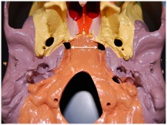 <p>Irregularly shaped opening on the external skull surface</p>