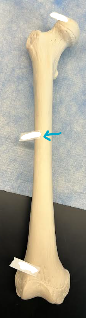 <p>ID femur region </p>