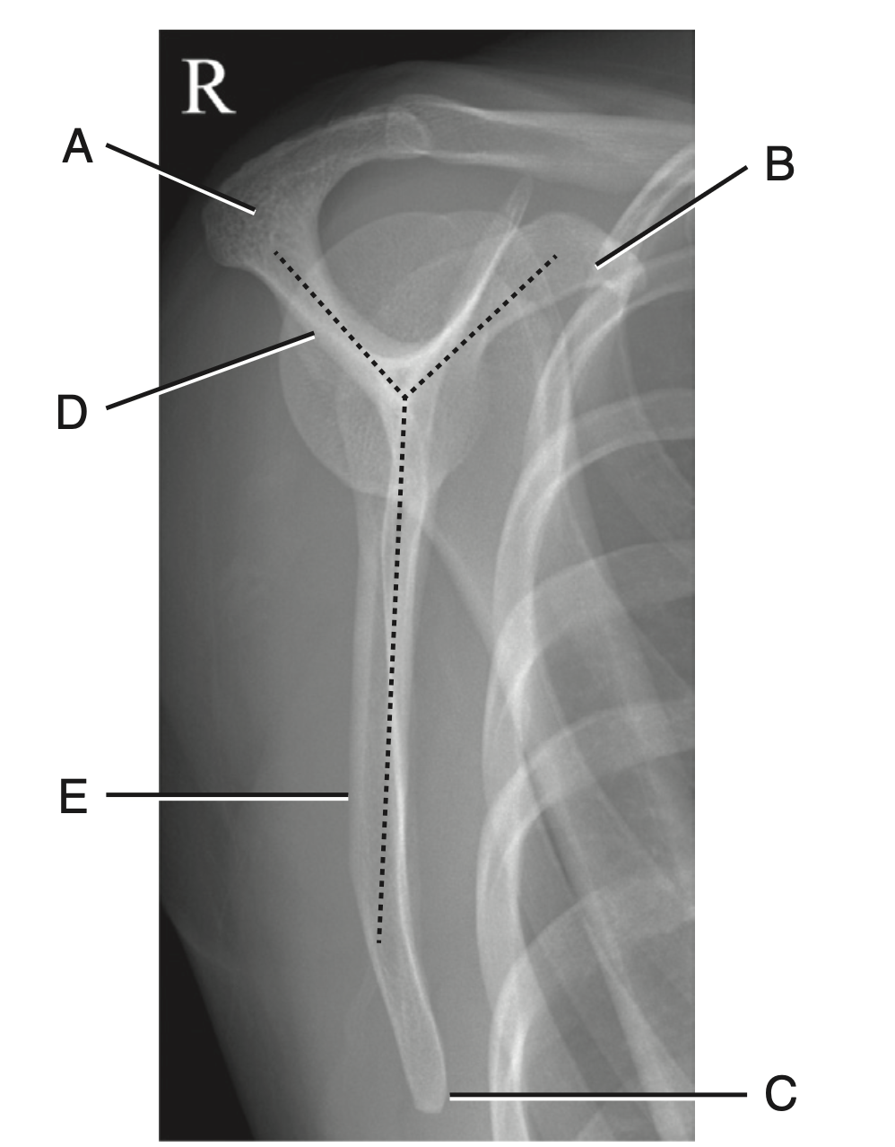 <p>Identify projection and identify A-E</p>