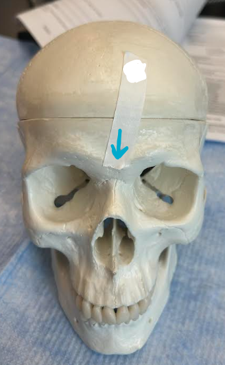<p>ID skull region</p>