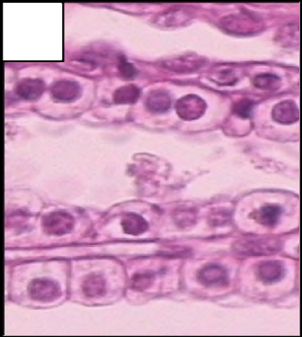 <p>ONE layer (simple) of cube shaped cells (cuboidal)</p>