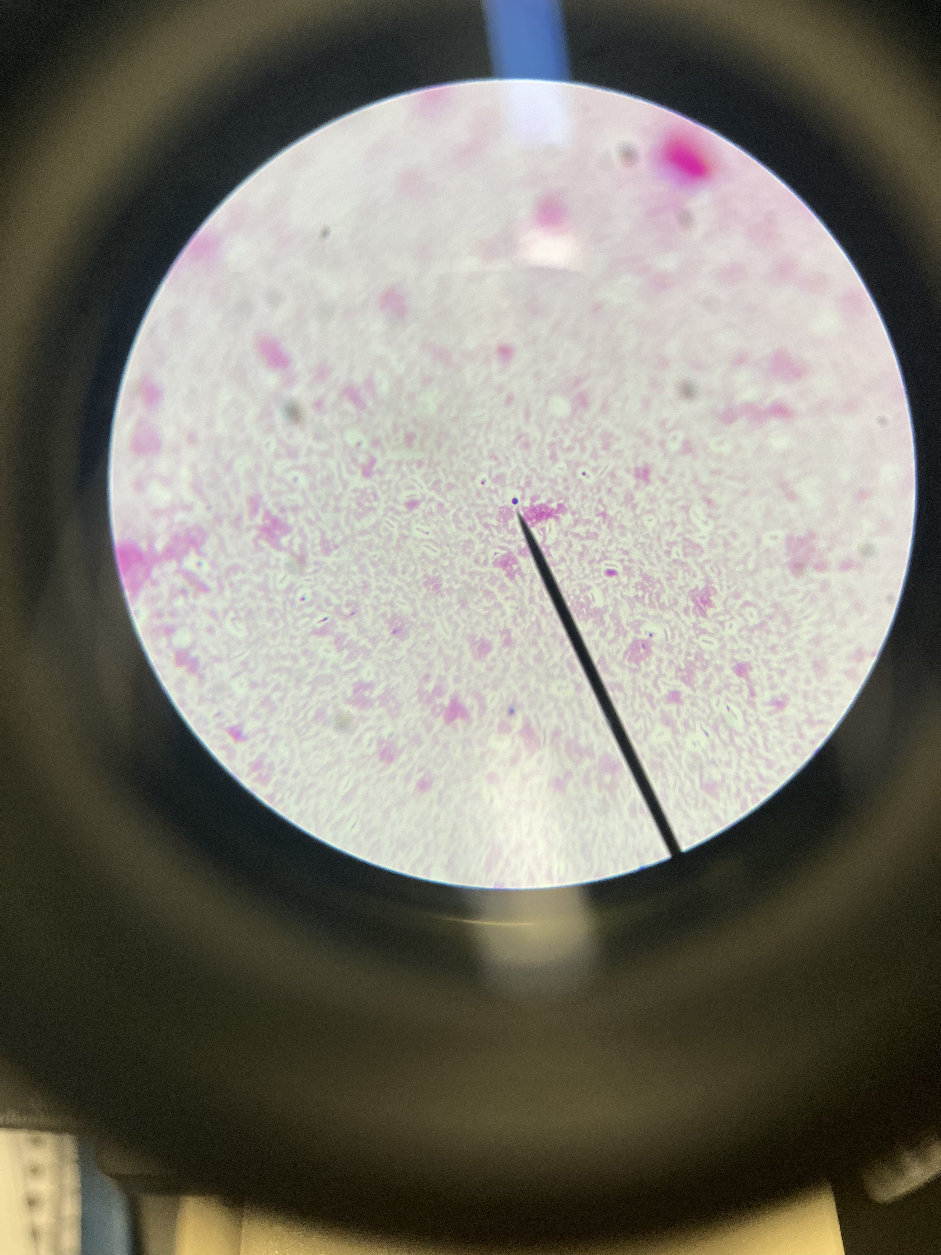 <ul><li><p>kingdom: <strong>Monera</strong></p></li><li><p>cell type:<strong> Prokaryotic</strong></p></li><li><p><strong>Bacilli</strong></p></li><li><p><strong>capsule</strong> —> slime coating, protection</p></li><li><p>modified <strong>negative stain</strong> (<em>background stained)</em></p></li><li><p><em>1000x</em></p></li></ul><p></p>