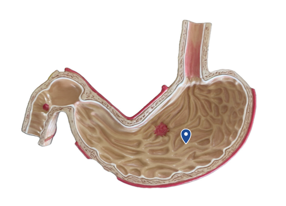 <p>Name this organ.</p>