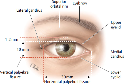 <p>Medial canthus*</p>