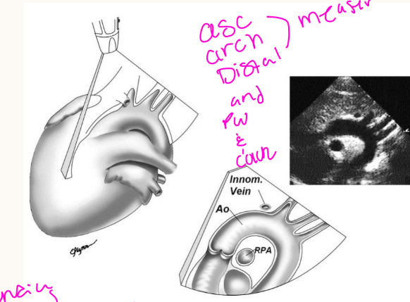 <p>What aortic measurements are obtained in suprasternal long axis?<br>→ Proximal and distal transverse arch and aortic isthmus diameters</p><p>What flow is evaluated in suprasternal long axis?<br>→ Flow along the aortic arch and proximal descending aorta</p>