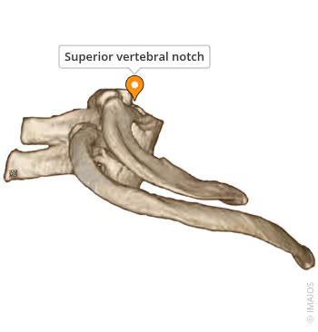 <p>What General Structure of Vertebrae? </p>