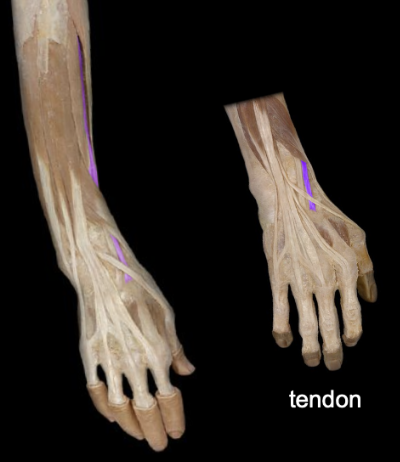 <p>What the highlighted structure is acting on the <strong><mark data-color="#ffdb9c" style="background-color: rgb(255, 219, 156); color: inherit;">Wrist and Hands</mark>.</strong> What muscle is this called?</p>