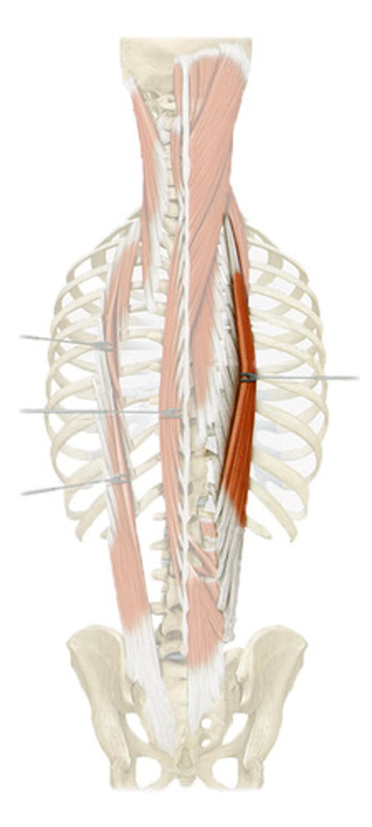 <p>transverse processes T vertebrae</p>