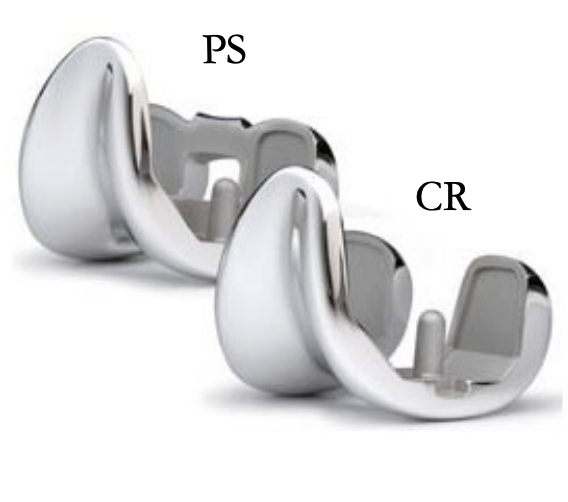 <p>3 types: <strong>All types REMOVE ACL</strong></p><ul><li><p>CR = Cruciate retraining (PCL retained) </p></li><li><p>PS = posterior stabilized</p></li><li><p>RP = rotating platform </p></li></ul><p></p>