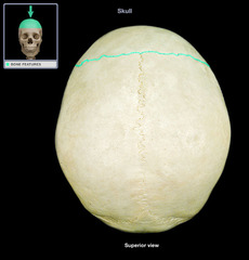 <p>What suture is 90 degrees to saggital suture separating the parietal bone from frontal bone?</p>