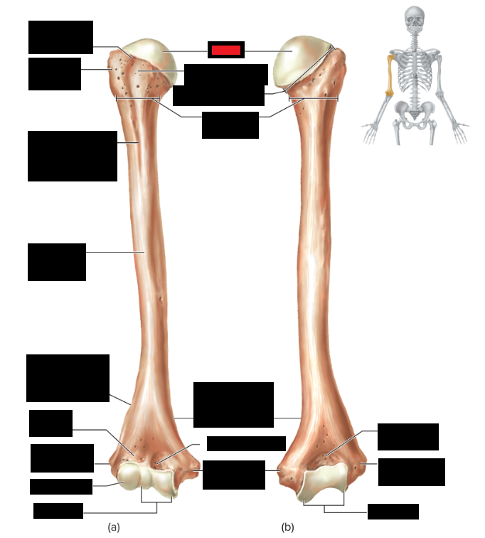 <p>Which part of the humerus is this?</p>