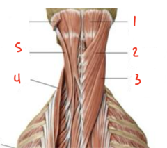 <p>What muscle is labeled 2?</p>