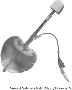 <p><strong>:</strong><span style="background-color: var(--color5);"><u> Balloon dissectors are not used to enter the peritoneal space</u></span>. <span style="background-color: var(--color1);"><u>They are used to separate extraperitoneal tissue planes by percutaneous insertion</u></span></p>
