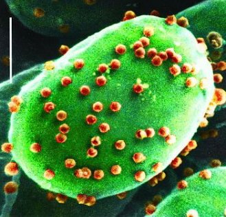 <ul><li><p>Acanthocystis turfacea chlorella virus 1</p></li><li><p>giant dsDNA virus</p></li><li><p>type of Chlorovirus → infects green algae, common in fresh water like lakes and ponds</p></li><li><p>virus associated with reduced cognitive functioning</p></li></ul><p></p>