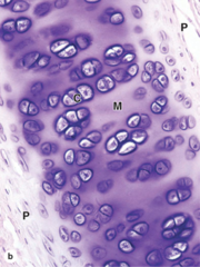 <p>What type of cartilage is shown?</p>