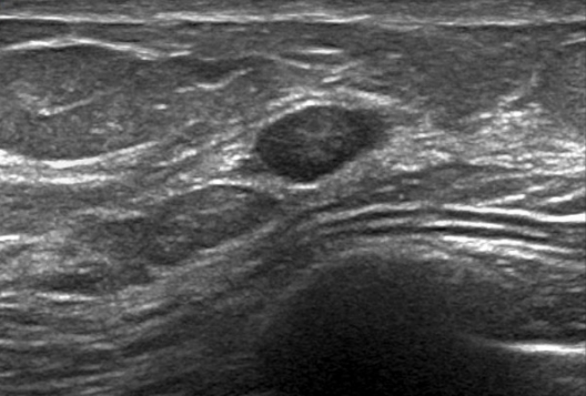 <p>Describe this pathology </p>