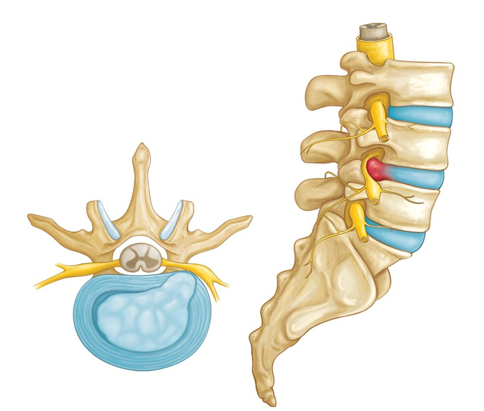 <p>What injury / condition? </p>