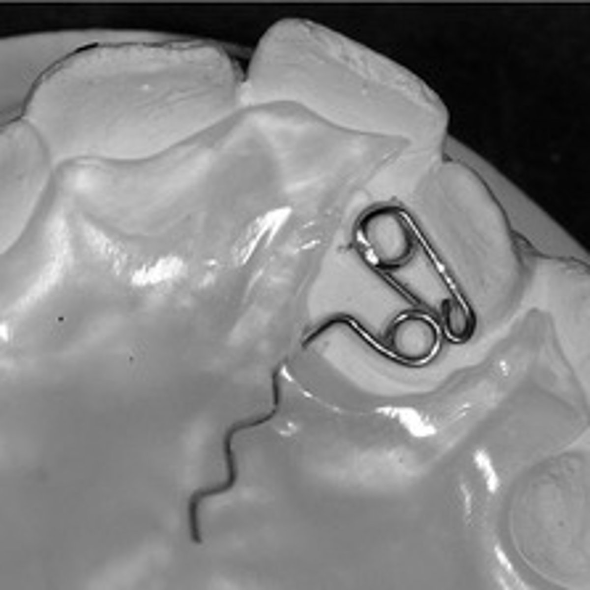 <p>ID the component:</p>
