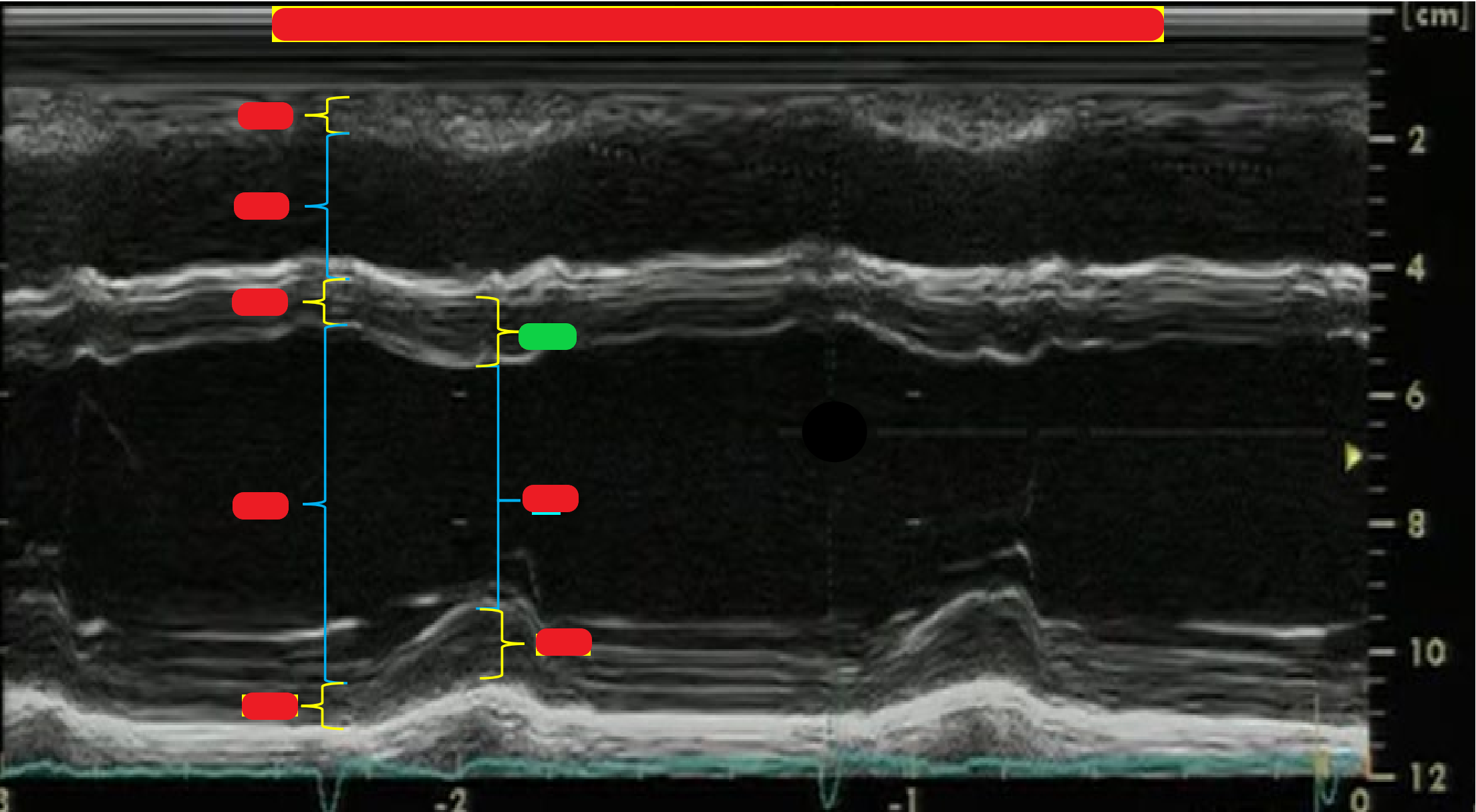 <p>What is highlighted in green?</p>