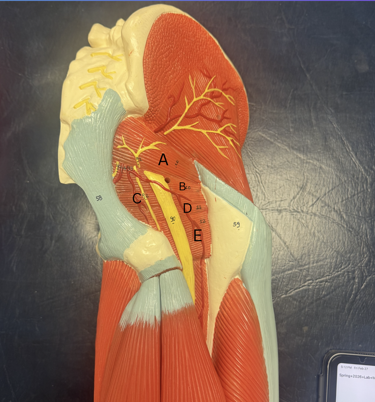 <p>Label these muscles </p>