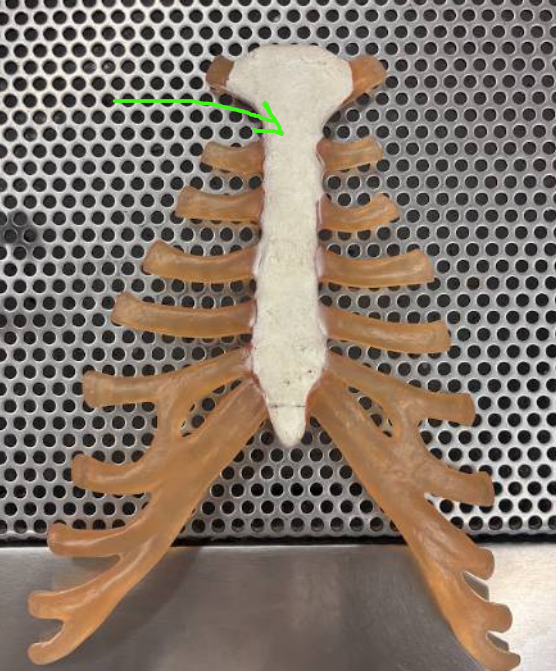 <p>What bone is the green arrow pointing to?</p>