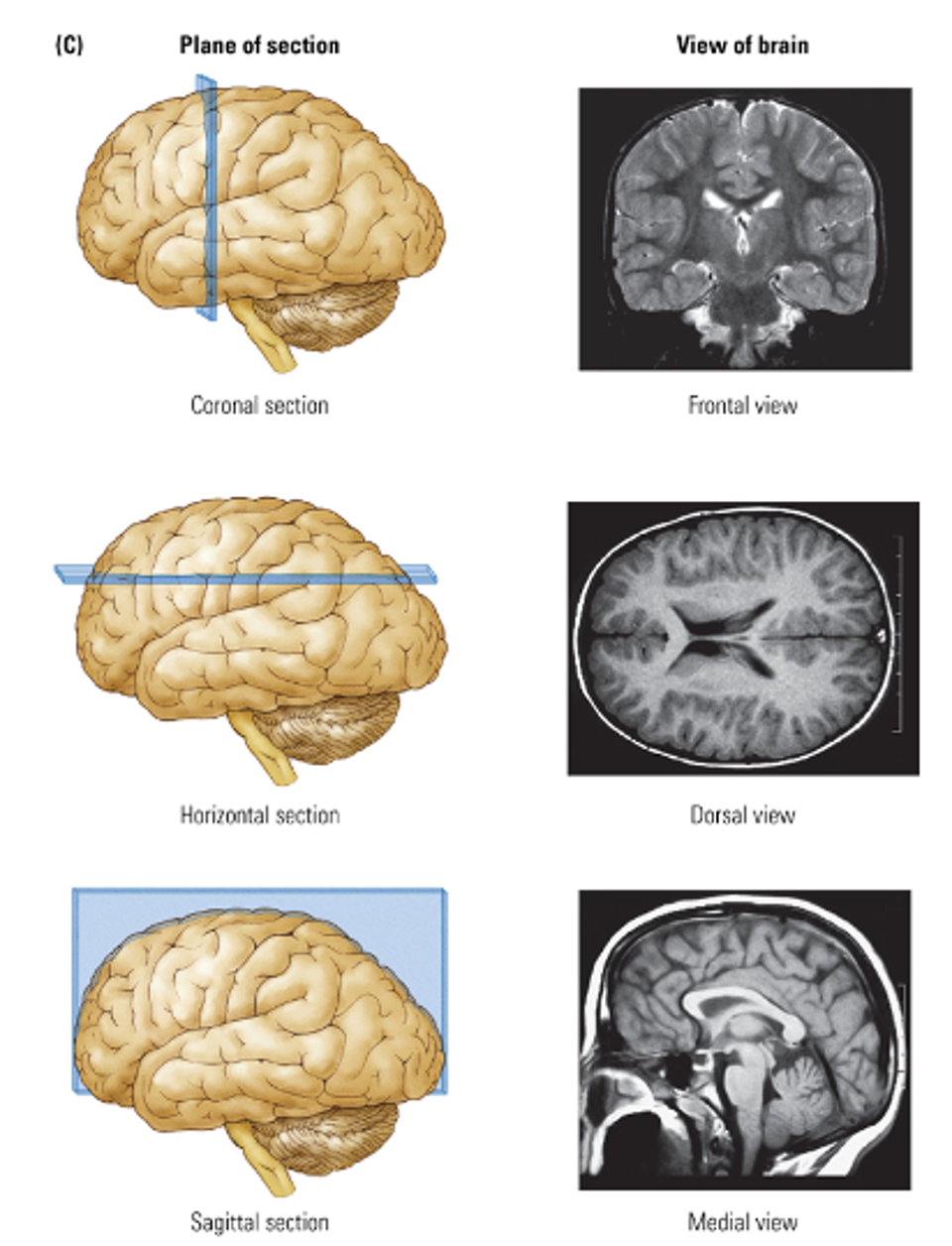 <ul><li><p>Coronal section → Frontal view</p></li><li><p>Horizontal section → Dorsal view</p></li><li><p>Sagital section → Medial view (clear access to hypothalamus pituitary)</p></li></ul><p></p>