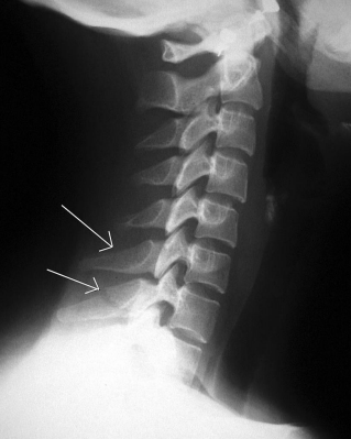 <p>Clay Shoveler’s Fx</p>