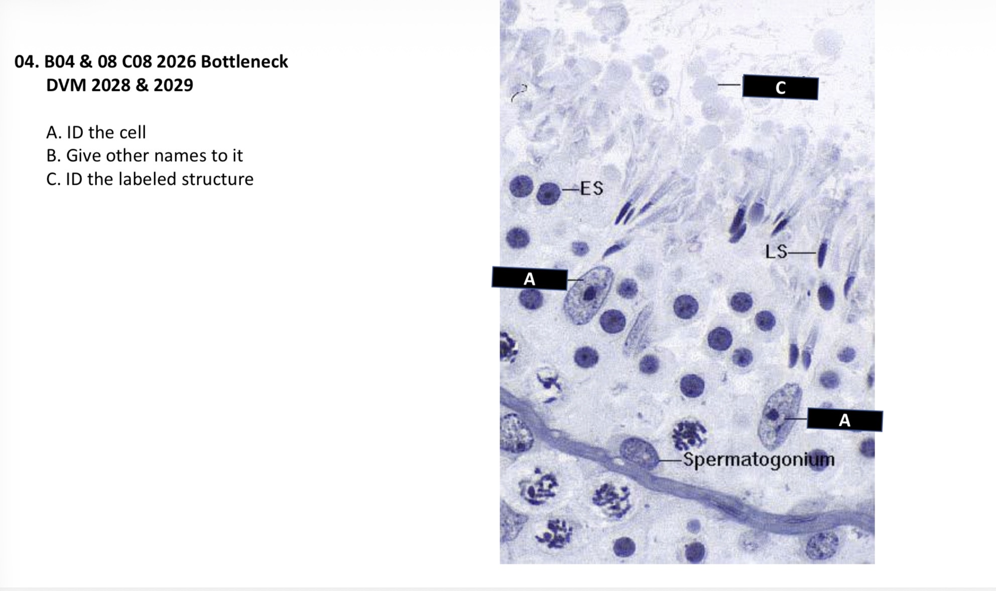 <p>A. Sertoli cell</p><p>B. Sustentacular, mother, nouritiong, supporting </p><p>C. Lipid droplet</p>