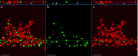 <p>red colored (green light) stain for <strong>dead cells only</strong></p>