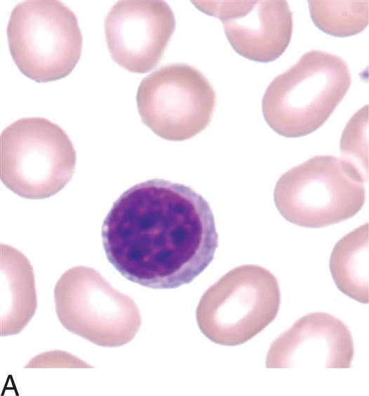 <p>what is a small lymphocyte?</p>