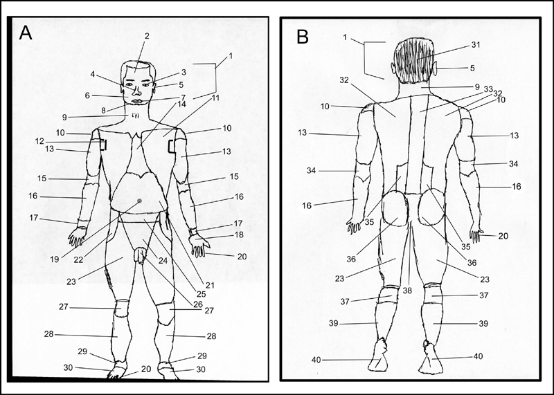 <p>what region of the body is 13?</p>