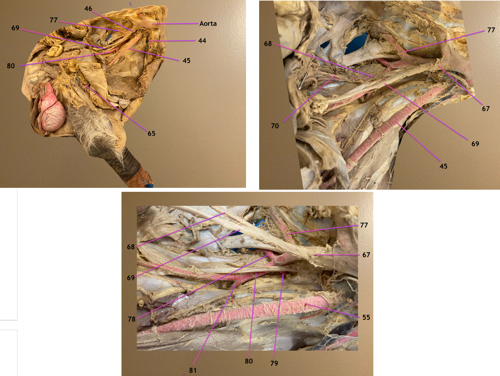 <p>pic 1: medial view of left pelvic wall, cranial to rt</p><p>pic 2: zoomed in on branches of aorta</p><p>pic 3: zoomed in on branches of internal iliac (67)</p><p>.</p><p>label 68-70, 77</p><p>name 70 in male &amp; female</p><p>.</p><p><em>note: 45 &amp; 55 are external iliac a.</em></p>