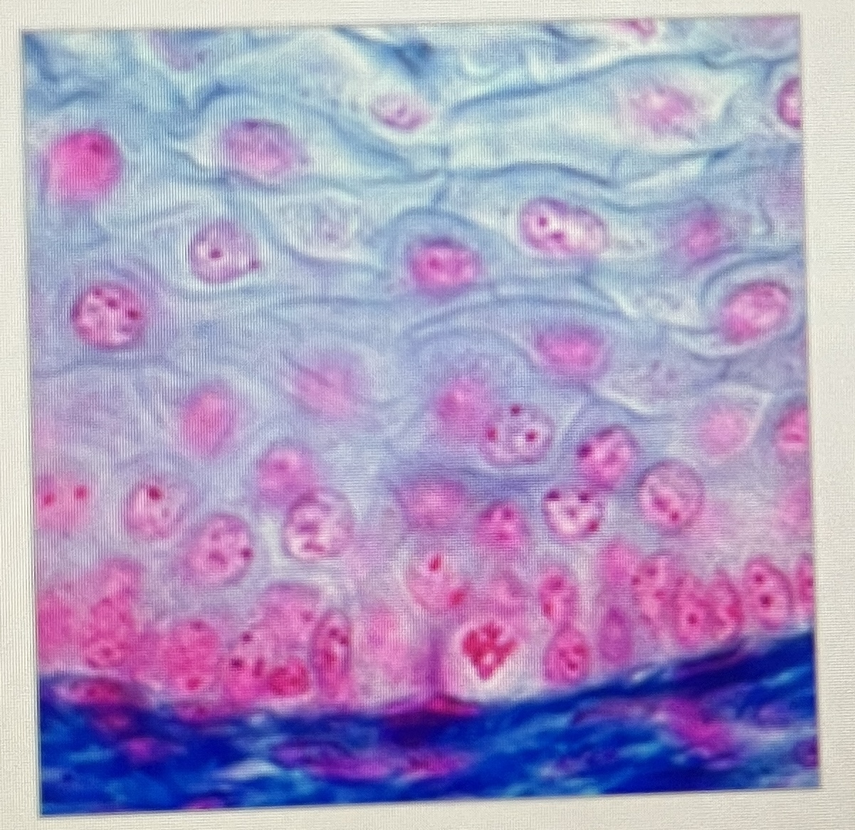 <p>Simple epithelial or stratified epithelial?</p>