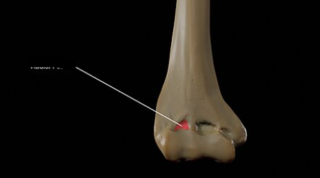 <p>What bone landmark is this within the <strong>Humerus </strong></p>
