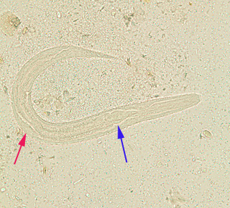 <p>What adult roundworm is this?</p>