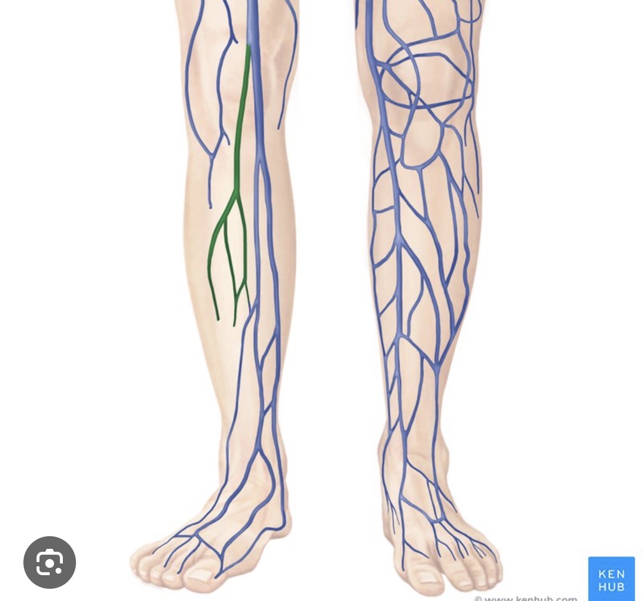 <p><span><span>a superficial vein that runs along the back of the lower leg, starting from the lateral side of the foot and traveling upward. It drains deoxygenated blood from the surface of the foot and posterior leg, and typically empties into the </span></span><a target="_blank" rel="noopener noreferrer nofollow" class="link" href="chatgpt://generic-entity?number=0" data-prevent-progress="true"><span><u><span>popliteal vein</span></u></span></a><span><span> behind the knee.</span></span></p>