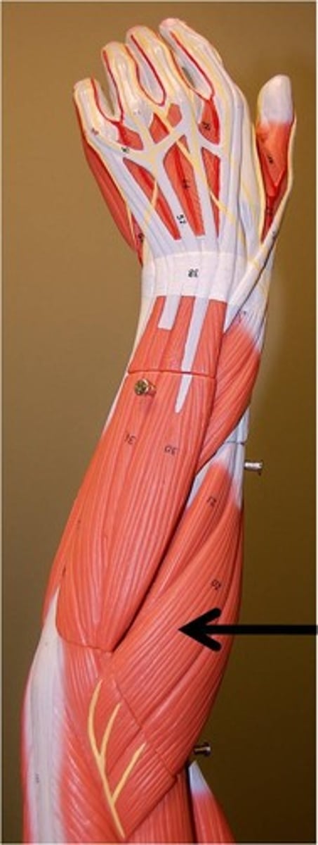 <p>Extends wrist and abducts hand</p>