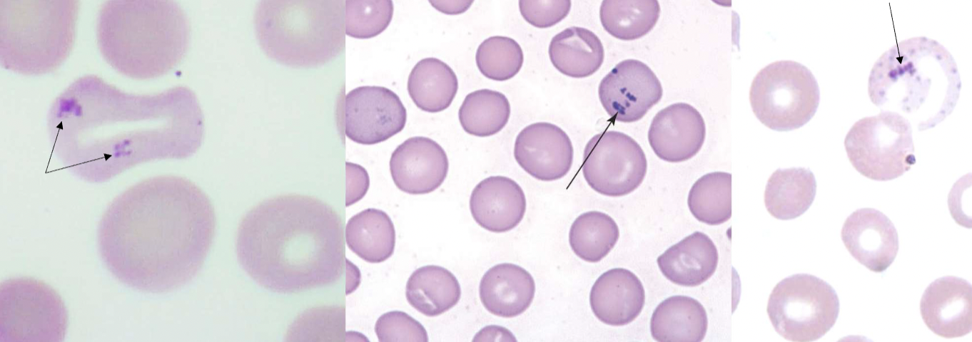<p>name the type of RBC inclusion</p>