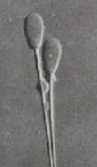 <p>What is this? Normal or abnormal sperm?</p>