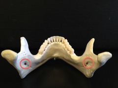 <p>What foramen is shown?</p>